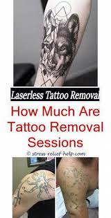Is R20 Tattoo Removal Safe Chest Tattoo Removal How Much Does Tattoo Removal Hurt Tattoo Removal 7115612837 Laser Tattoo Eyebrow Tattoo Removal Tattoo Paper