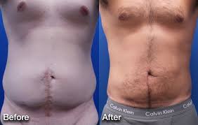 Pin On Plastic Surgery Cosmetic Procedures