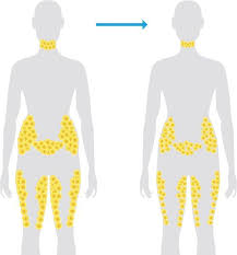 Pin On Coolsculpting Magic