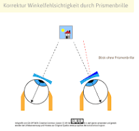 Winkelfehlsichtigkeit | QS-OPTIKER