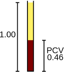 Hematocrit Wikipedia