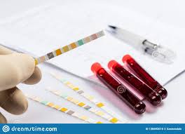 Test Tubes With Blood Stock Photo Image Of Illness 136693510