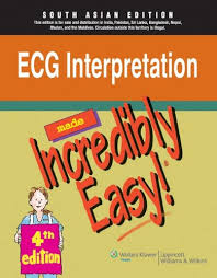 Ecg Interpretation Made Incredibly Easy