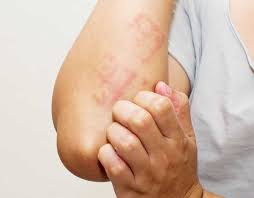 Maybe you would like to learn more about one of these? Conoce Todos Los Sintomas De La Leucemia