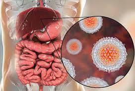 The inflammation can affect how your liver works and cause other signs and symptoms of hepatitis a. What Is Hepatitis A Hep A Vaccine Symptoms Treatment Contagious
