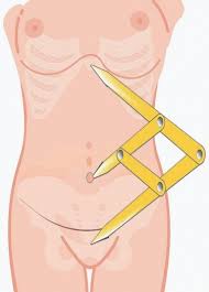 Image result for Umbilicus