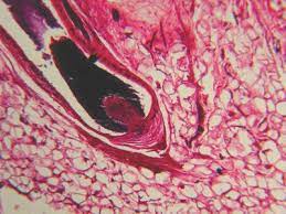 Integumentary System Histology Hair Follicle Histology Slide Integumentary System Scalp Problems Hair Follicle