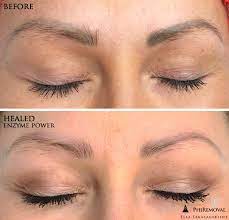 Wipe out the sweat with the help of cotton balls. Eyebrows Removal With Phiremoval Enzyme Power Eyebrows Microblading How To Remove