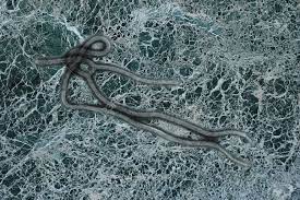 Yet the coronavirus genome remains a mystery, especially to those outside the scientific community. Ebola Virus Seen Under A Microscope With Epidemic Sign Stock Photo Picture And Royalty Free Image Image 31053232