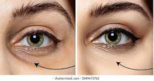 5+ Hundred Eye Cream Before After Royalty-Free Images, Stock Photos &  Pictures | Shutterstock