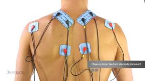 Trapezius Muscles Electrode Placement For Compex Muscle Stimulators