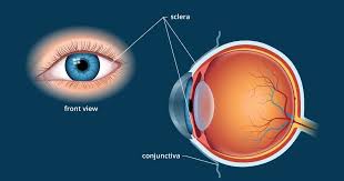 The phrase originally had anatomical 26.08.2019 · today, the meaning of the expression 'apple of my eye' has to do with cherishing something. Sclera White Of The Eye Definition And Detailed Illustration