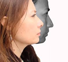 Rinoplastia