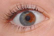 Eye Color Wikipedia