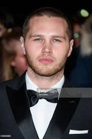 Child of croatian ancestry austrian klaus brandauer bavarian gã¼nther beck. Epicanthic Fold Irish Epicanthal Folds