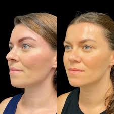 Robb Facial Plastic Surgery...