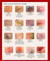 Lesions Are Structural Changes In The Tissues Cause By Damage Or Injury Signs Any Mark Wound Or Abnormally Dermatology Nurse Wound Care Nursing Wound Care