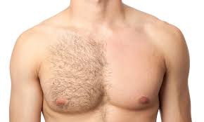 Do not pay for a full body laser hair removal package unless you are sure you do not want hair, ever. Laser Hair Removal Treatment In London Best Laser Room