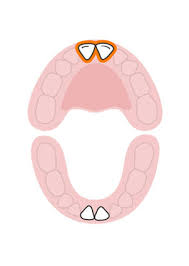 Baby Teeth Chart What Order Do Babies Teeth Come In