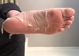 I Tried Baby Foot And My Feet Have Never Looked Or Felt Smoother In 2020 Foot Peel Baby Feet Peel Baby Feet