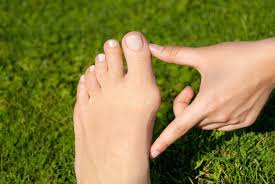 Überzeugen sie sich von unseren zahlreichen urlaubsangeboten. Lateral Foot Pain Symptoms Causes And Treatment