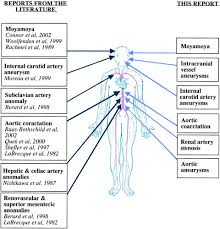 Vascular Anomalies In Alagille Syndrome Circulation