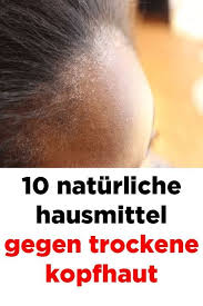 10 Naturliche Hausmittel Gegen Trockene Kopfhaut Dry Scalp Remedy Beauty Hacks Dry Scalp