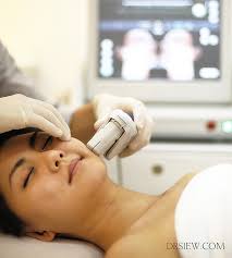 In a nutshell, it causes damage to the collagen layers of the skin and this in turn regulates new collagen. Ultherapy New Perspectives Everything You Need To Know