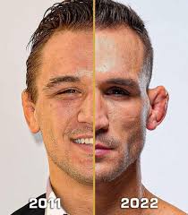 Michael Chandler What A Guy Has more losses than wins in the ufc lol but  dammmn this guy so much fun to watch Heart of a warrior 💪