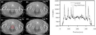 Ghosting and image artifacts can be a real problem on even the best pc monitors. Pdf An Empirical Method For Lag Correction In Cone Beam Ct Semantic Scholar