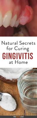 Green tea isn't only good for your teeth because of its fluoride content. How To Strengthen Teeth And Gums Naturally Arxiusarquitectura