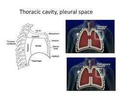 By: Jodi Tidwell BSN, RN.  To place a tube in the pleural space to  decompress a tension pneumothorax or fluid accumulation in order to allow  adequate.