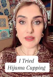 I Tried Hijama (Wet Cupping)