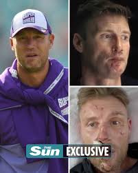 Freddie Flintoff reveals 'I wished I'd been killed' in horrifying crash and  admits 'I didn't think I'd make it' 😢 🗣️ “After the accident I didn't  think I had it in me