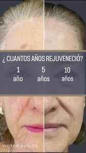 Dr Victor Avalos (@dr.victoravalos)