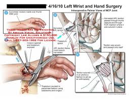 Pin On Anatomy