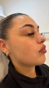 Your wish is my command ✨💉, Expertise that are evident… here we have  carefully placed filler to create a more desirable profile