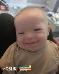 For this week's #PADSSundaySmiles we hear from mum Sami about little George  💛 George's first proper smile at 9 weeks and now he's 15 weeks old and  always smiling!🧡 #sundaysmiles #nobodytoldme #positiveaboutdownsyndrome #