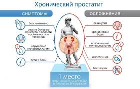 Prichiny Simptomy Diagnostika I Lechenie Prostatita V Ufe Promedicina Ufa
