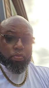 I Got A Bald Head Tyrone