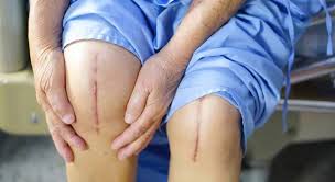 بهترين جراح زانو در شيراز