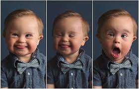 Down syndrome is a set of symptoms that arise from a genetic abnormality, in which an individual's cells have an extra. Die Schonheit Von Down Syndrom