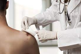 Jedną z nich jest nakładanie opatrunku okluzyjnego z żelem na. Opatrunek Okluzyjny Czym Jest I Kiedy Go Stosowac Poradnikzdrowie Pl