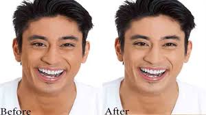 Pin On Zeta White Skin Whitening Cream