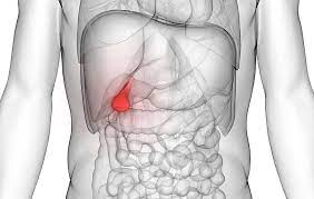 6 Gallstone Symptoms You Should Know About ​​​ | Women's Health