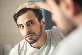 So i didn't go quite bald, but the look isn't so bad! 10 Things You Should Know About Male Hair Loss