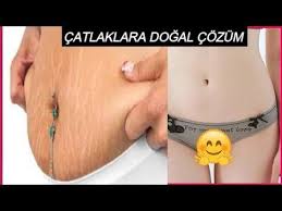 5 dakikada catlaklari kolay ve hizli sekilde gideren dogal yontem catlaklara cozum guzellik bakim youtube dogal cilt bakimi hamilelik sonrasi cilt rengi