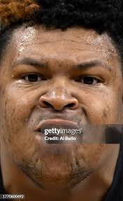 Gold medalist David Curtiss of Team United poses