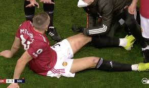 Learn all the details about alexandre jankewitz (alexandre jankewitz), a player in southampton on as.com. Man Utd Star Scott Mctominay Shows Off Wounds After Brutal Alexandre Jankewitz Tackle Football Sport Express Co Uk