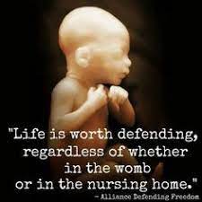 As god is the creator of all life, only he should say when life begins or ends. 22 Sanctity Of Life Ideas Choose Life Pro Life Life